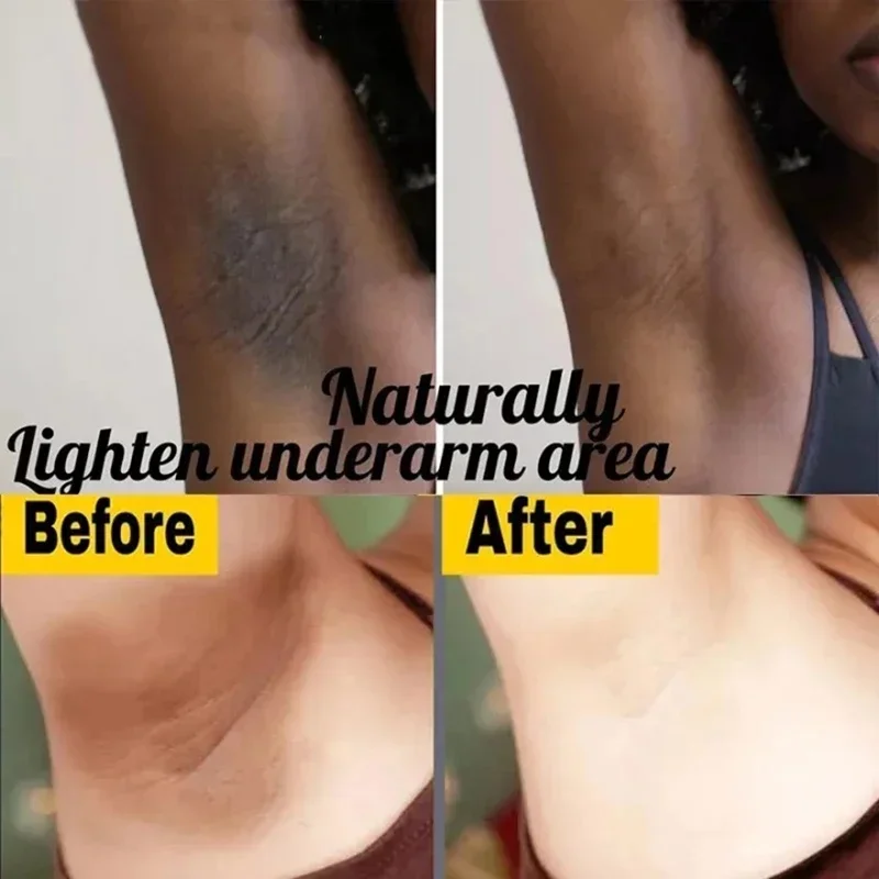 Brightening Cream For Intimate - огляд і ціна Luxury Lifestyle Products