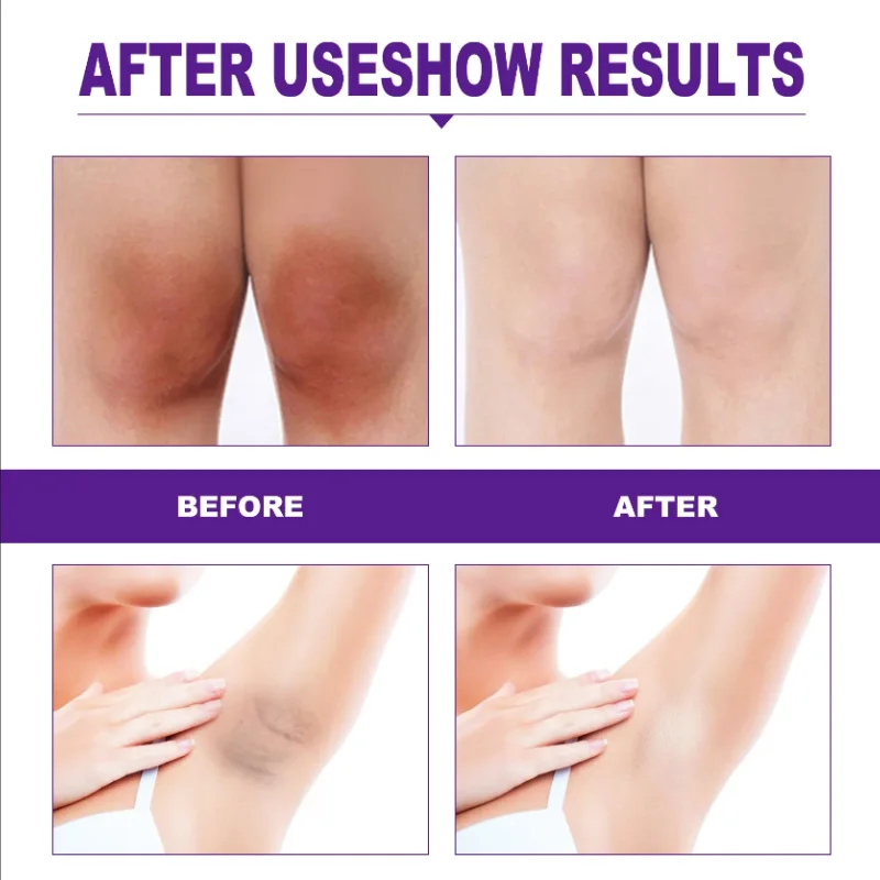 Brightening Cream For Intimate - огляд і ціна Luxury Lifestyle Products